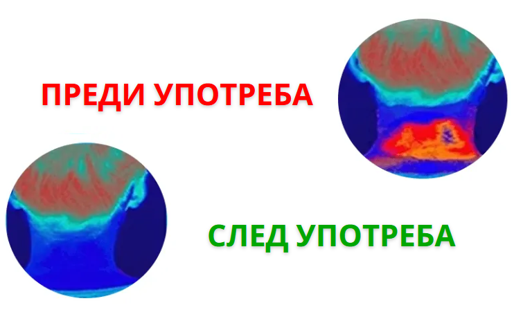Декомпресионен уред за врат